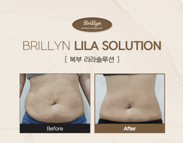 Brillyn clinic clinic, photo 5